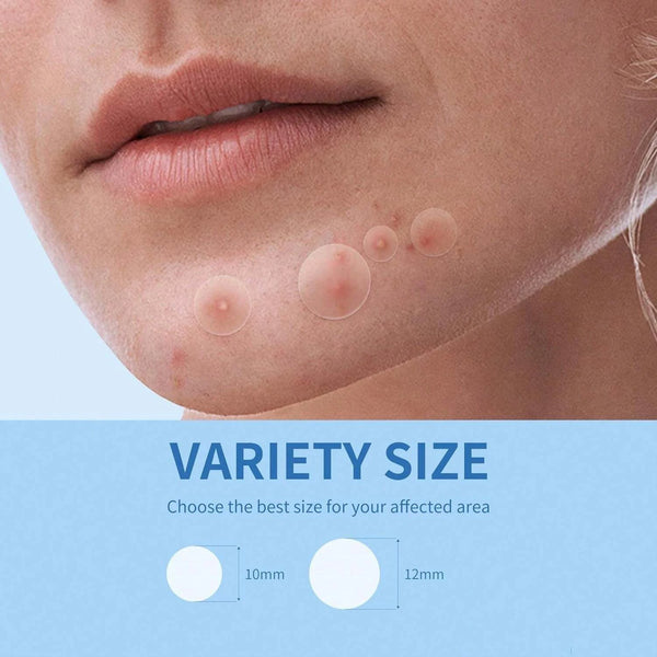 40-400-Pieces-Hydrocolloid-Acne-Patches-per-Box-Alcohol-Free-Gentle-Non-Irritating-Blemish-Covering-Sticker.jpg
